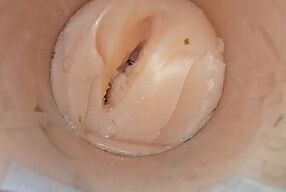 Camera deep inside tight pussy captures huge cum explosion