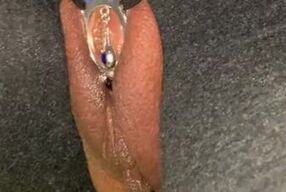 Stimulating